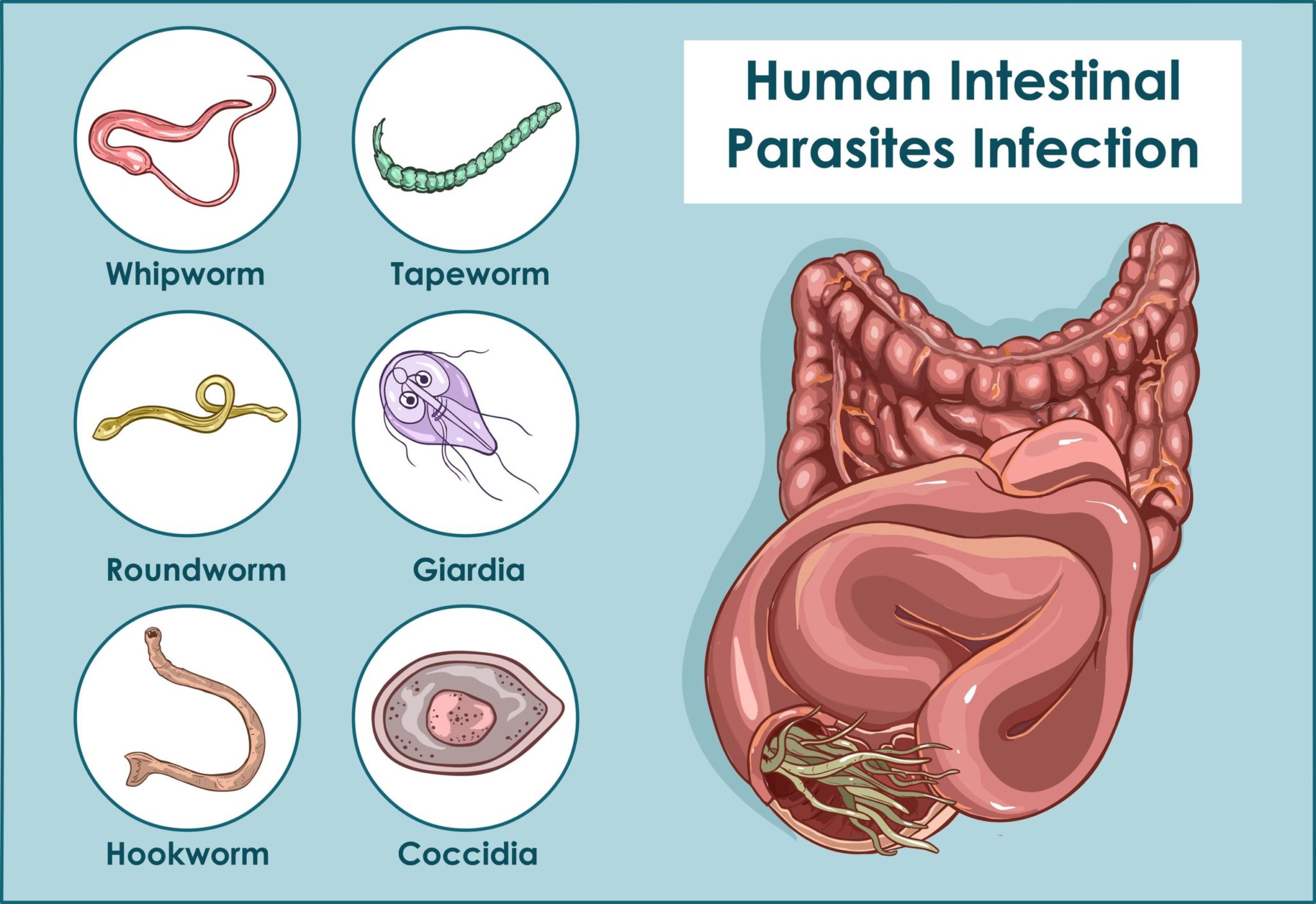 do-you-have-parasites